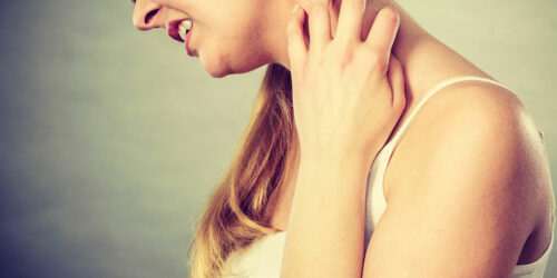 8 Home Remedies for Chronic Urticaria