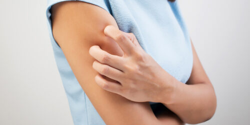 How to Get Rid of Skin Mites