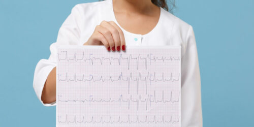 Echocardiogram – Purpose, Preparation, and Procedure