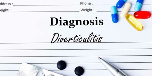 7 Probiotic-Rich Foods to Try When Dealing with Diverticulitis