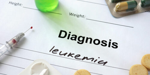 Acute Myeloid Leukemia – Stages, Types, Symptoms, Causes, and Therapies