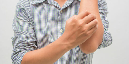 Jock Itch Disease – Its Symptoms, Causes, and Diagnoses