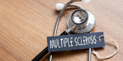 Multiple sclerosis – Things you need to know