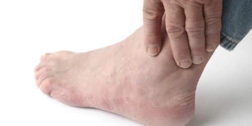 3 Daily habits to avoid foot pain