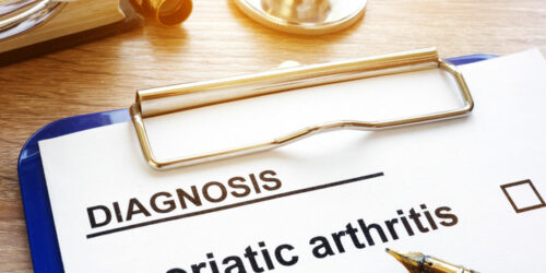 A guide to the symptoms of psoriatic arthritis
