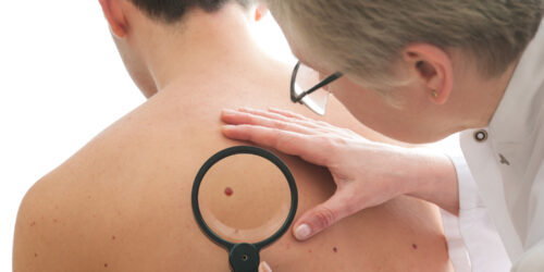 All About Cellulitis – Causes, Symptoms, And Treatment