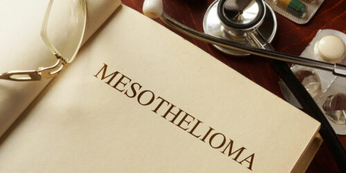All you need to know about mesothelioma and its symptoms