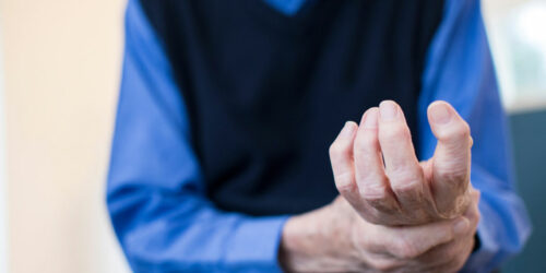 Common symptoms of rheumatoid arthritis