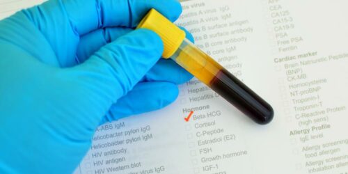 Different Types of Immunotherapy to Fight Cancer