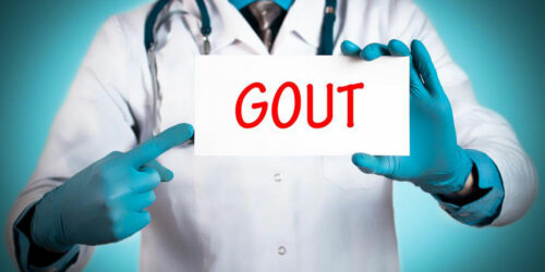 Easy Gout Remedies to Help Manage Pain