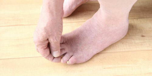 Fibromyalgia Foot Pain – Factors to Understand