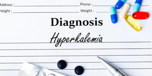 Hyperkalemia – Symptoms, causes, and treatments