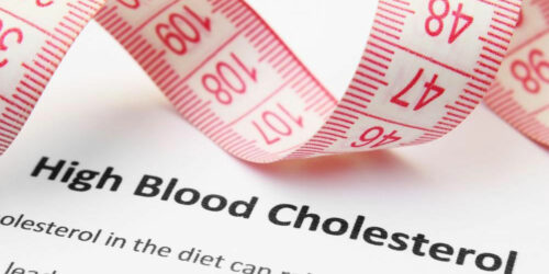 High Cholesterol – Symptoms and Treatment Options