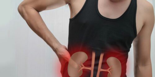 Kidney Failure – Causes and Symptoms