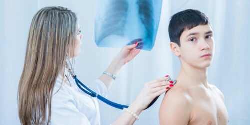 Pneumococcal Pneumonia – Symptoms, Treatment, and More
