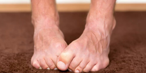 Simple Ways To Cure Neuropathic Pain Naturally