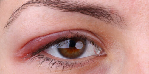 Tips to keep an eye on your eyes