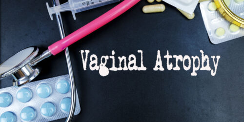 Vaginal Atrophy Treatment – An Overview