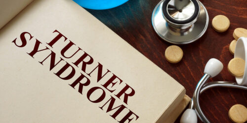 Turner Syndrome – Causes, Symptoms, and Management