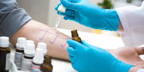 Testing Gluten Sensitivity – Key Symptoms, Methods, and Benefits