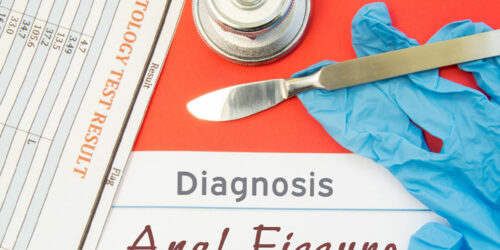 Anal Fissures – Its Causes, Symptoms, and Management